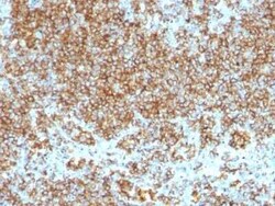 CD45 Antibody (SPM569 + SPM570) - IHC-Prediluted, Novus Biologicals 7 mL,