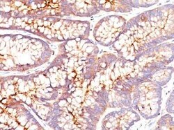 CEACAM5/CD66e Antibody (SPM541) - IHC-Prediluted, Novus Biologicals 7 mL,