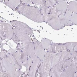 CLIC4 Antibody, Novus Biologicals:Antibodies:Primary Antibodies