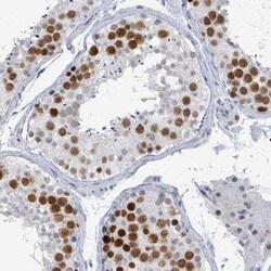 CT45A1 Antibody, Novus Biologicals 0.1 mL | Buy Online | Novus Biologicals | Fisher Scientific