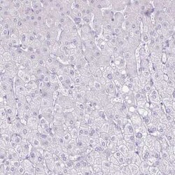CT45A1 Antibody, Novus Biologicals:Antikörper:Primärantikörper