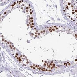 CT45A1 Antibody, Novus Biologicals:Antikörper:Primärantikörper