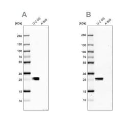 CT45A1 Antibody, Novus Biologicals:Antikörper:Primärantikörper