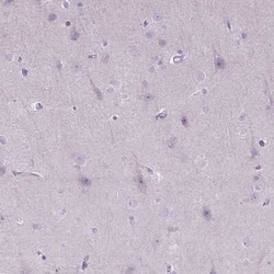 CTAG2 Antibody, Novus Biologicals 0.1 mL | Buy Online | Novus Biologicals | Fisher Scientific
