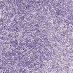 CTAG2 Antibody, Novus Biologicals 0.1 mL | Buy Online | Novus Biologicals | Fisher Scientific