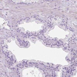 CXCL4/PF4 Antibody, Novus Biologicals 25 &mu;L, Unconjugated:Antibodies,
