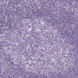 CXCL4/PF4 Antibody, Novus Biologicals 25 &mu;L, Unconjugated:Antibodies,