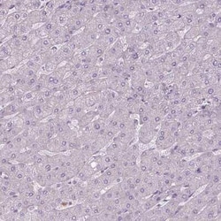 CaM Kinase II alpha Antibody, Novus Biologicals 25 &mu;L, Unconjugated:Anticuerpos