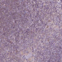 CaM Kinase II alpha Antibody, Novus Biologicals 25 &mu;L, Unconjugated:Anticuerpos