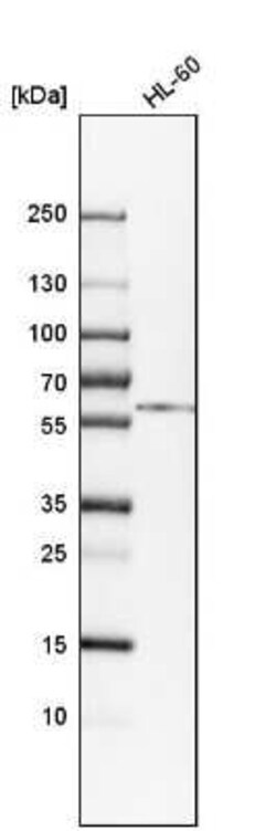 Calreticulin Antibody, Novus Biologicals 0.1 mL, Unconjugated:Antikörper
