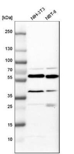 Calreticulin Antibody, Novus Biologicals 0.1 mL, Unconjugated:Antikörper
