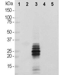 Calretinin Antibody (3G9), Novus Biologicals:Antibodies:Primary Antibodies