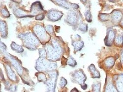 Chorionic Gonadotropin beta Chain (hCG beta) Antibody (SPM105) - IHC-Prediluted,