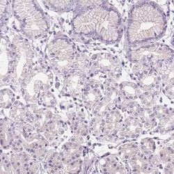 Claudin-17 Antibody, Novus Biologicals:Antibodies:Primary Antibodies