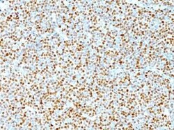 Cyclin D1 Antibody (DCS-6) - IHC-Prediluted, Novus Biologicals 7 mL, Unconjugated:Antibodies,