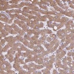 Cytochrome b5 type A Antibody, Novus Biologicals 0.1 mL | Buy Online | Novus Biologicals | Fisher Scientific