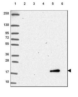 Cytochrome b5 type A Antibody, Novus Biologicals 0.1 mL | Buy Online | Novus Biologicals | Fisher Scientific