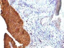 Cytokeratin 19 Antibody (SPM561) - IHC-Prediluted, Novus Biologicals 7