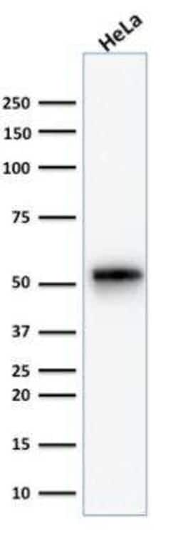 Cytokeratin 7 Antibody (KRT7/1499R) - Azide and BSA Free, Novus Biologicals