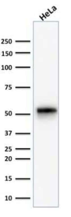 Cytokeratin 7 Antibody (KRT7/1499R), Novus Biologicals 0.1 mg | Buy Online | Novus Biologicals | Fisher Scientific