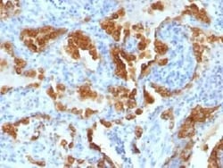 Cytokeratin 8 Antibody (H1+TS1) - IHC-Prediluted, Novus Biologicals 7 mL,