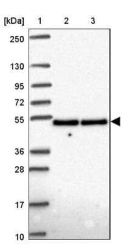 UAP56 Antibody, Novus Biologicals 25 &mu;L, Unconjugated:Antibodies, Polyclonal