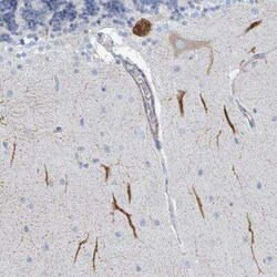 DMRTC1 Antibody, Novus Biologicals:Antibodies:Primary Antibodies