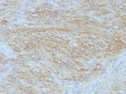 DOG1/TMEM16A Antibody (SPM580) - IHC-Prediluted, Novus Biologicals 7 mL,