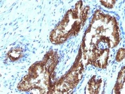 ETS1 associated protein II Antibody (TDP2/1258), Novus Biologicals:Antibodies:Primary