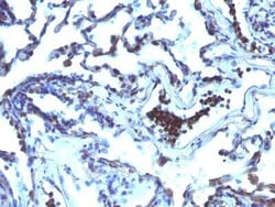 ETS1 associated protein II Antibody (TDP2/1258), Novus Biologicals:Antibodies:Primary