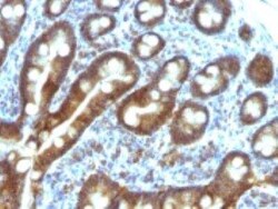 ETS1 associated protein II Antibody (TDP2/1258), Novus Biologicals:Antibodies:Primary
