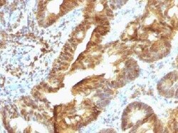 ETS1 associated protein II Antibody (TDP2/1258), Novus Biologicals:Antibodies:Primary