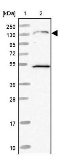 EVI-1 Antibody, Novus Biologicals 0.1 mL, Unconjugated:Antibodies, Polyclonal