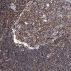 FNBP1 Antibody, Novus Biologicals 0.1 mL, Unconjugated:Antibodies, Polyclonal