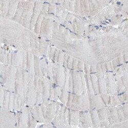 FNBP1 Antibody, Novus Biologicals 0.1 mL, Unconjugated:Antibodies, Polyclonal