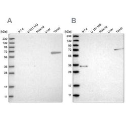 FNBP1 Antibody, Novus Biologicals 0.1 mL, Unconjugated:Antibodies, Polyclonal