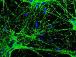 GAP-43 Antibody (5E8), Novus Biologicals 0.025 mL, Unconjugated:Antibodies,