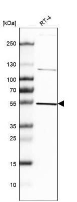 Hsp70 interacting protein HIP Antibody, Novus Biologicals 0.1 mL | Buy Online | Novus Biologicals | Fisher Scientific