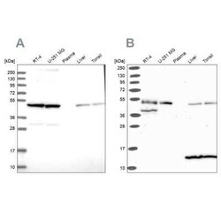 Hsp70 interacting protein HIP Antibody, Novus Biologicals 0.1 mL | Buy Online | Novus Biologicals | Fisher Scientific