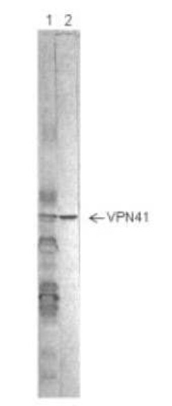 Human Respiratory Syncytial Virus Nucleoprotein VPN41 Antibody (4-18) -