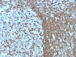 ICAM-3/CD50 Antibody (SPM505) - IHC-Prediluted, Novus Biologicals 7 mL,