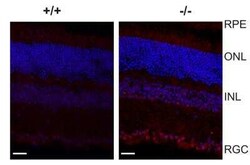 IRE1 alpha Antibody Pack, Novus Biologicals 3 Vials, Unconjugated:Antibodies,