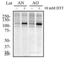 IRE1 alpha Antibody Pack, Novus Biologicals™