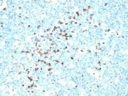 IgM Antibody (DA4-4 (same as SA-DA4 or HB57)) - IHC-Prediluted, Novus Biologicals