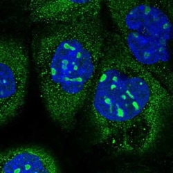 KNOP1 Antibody, Novus Biologicals 0.1 mL, Unconjugated:Antibodies, Polyclonal