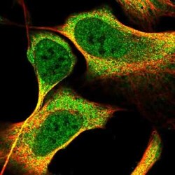 Kazrin Antibody, Novus Biologicals 25 &mu;L | Buy Online | Novus Biologicals | Fisher Scientific