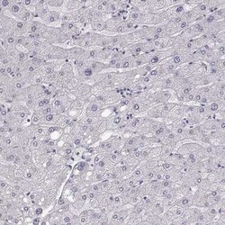 Keratin 31 Antibody, Novus Biologicals 25 &mu;L, Unconjugated:Antibodies,
