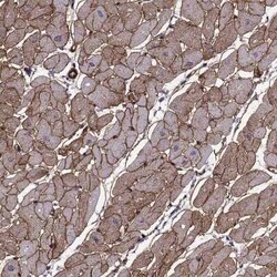 Laminin S/Laminin beta 2 Antibody (CL2979), Novus Biologicals 25 &mu;L,