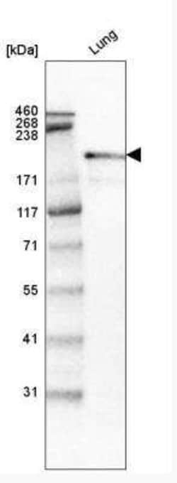 Laminin S/Laminin beta 2 Antibody (CL2979), Novus Biologicals 25 &mu;L,