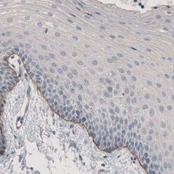 Laminin alpha 3 Antibody (CL3112), Novus Biologicals 0.1 mL, Unconjugated:Antibodies,